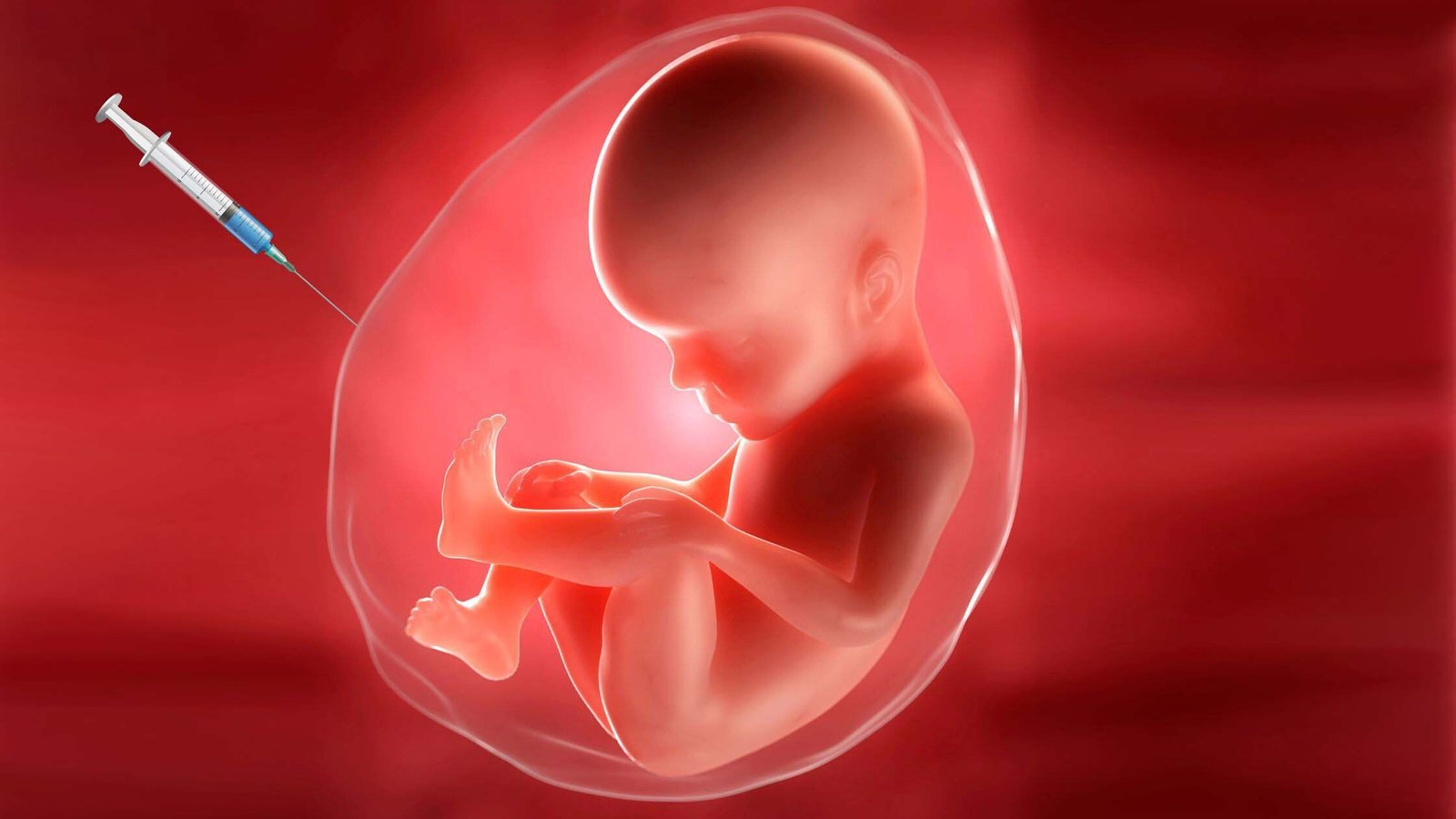 Amniocentesis Risk Factors