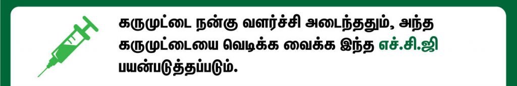 HCG Injection பயன்கள் என்ன? 9 human chorionic gonadotropin hormone