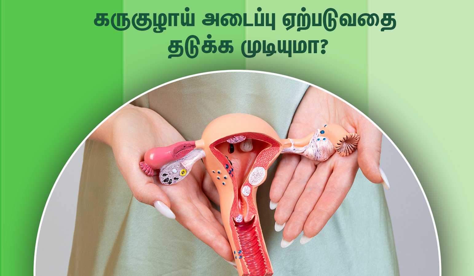 Prevent Fallopian Tube Blockage