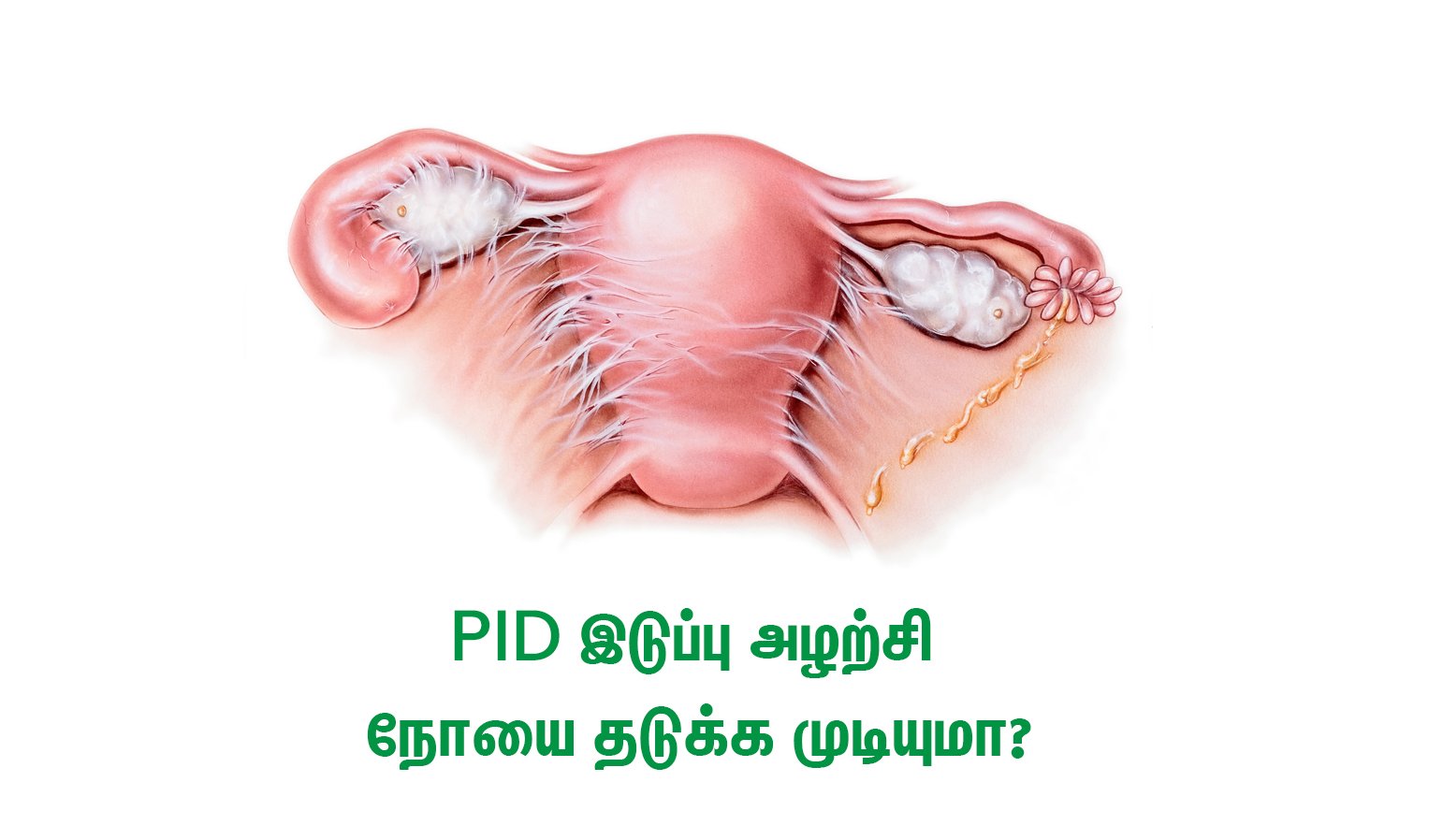 pid causes