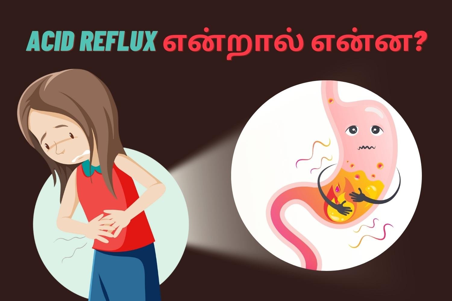 Acid Reflux 