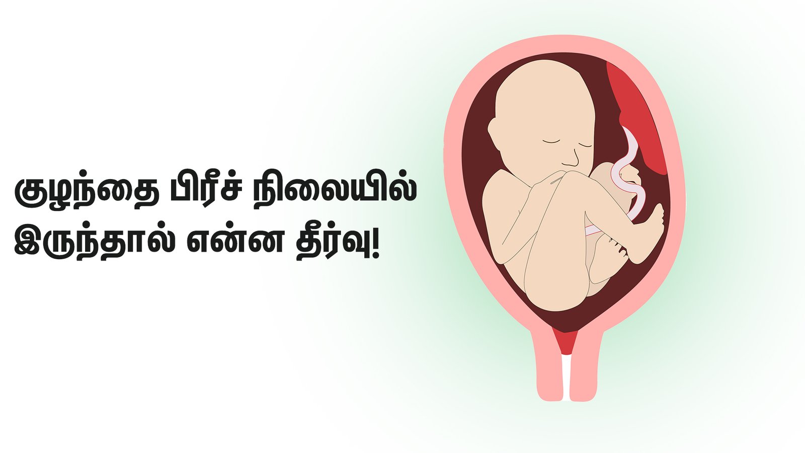 Breech Baby