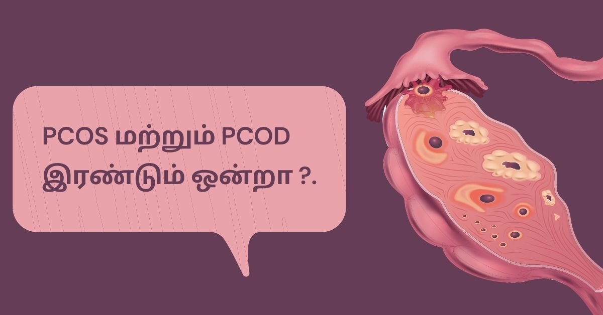 PCOS and PCOD difference